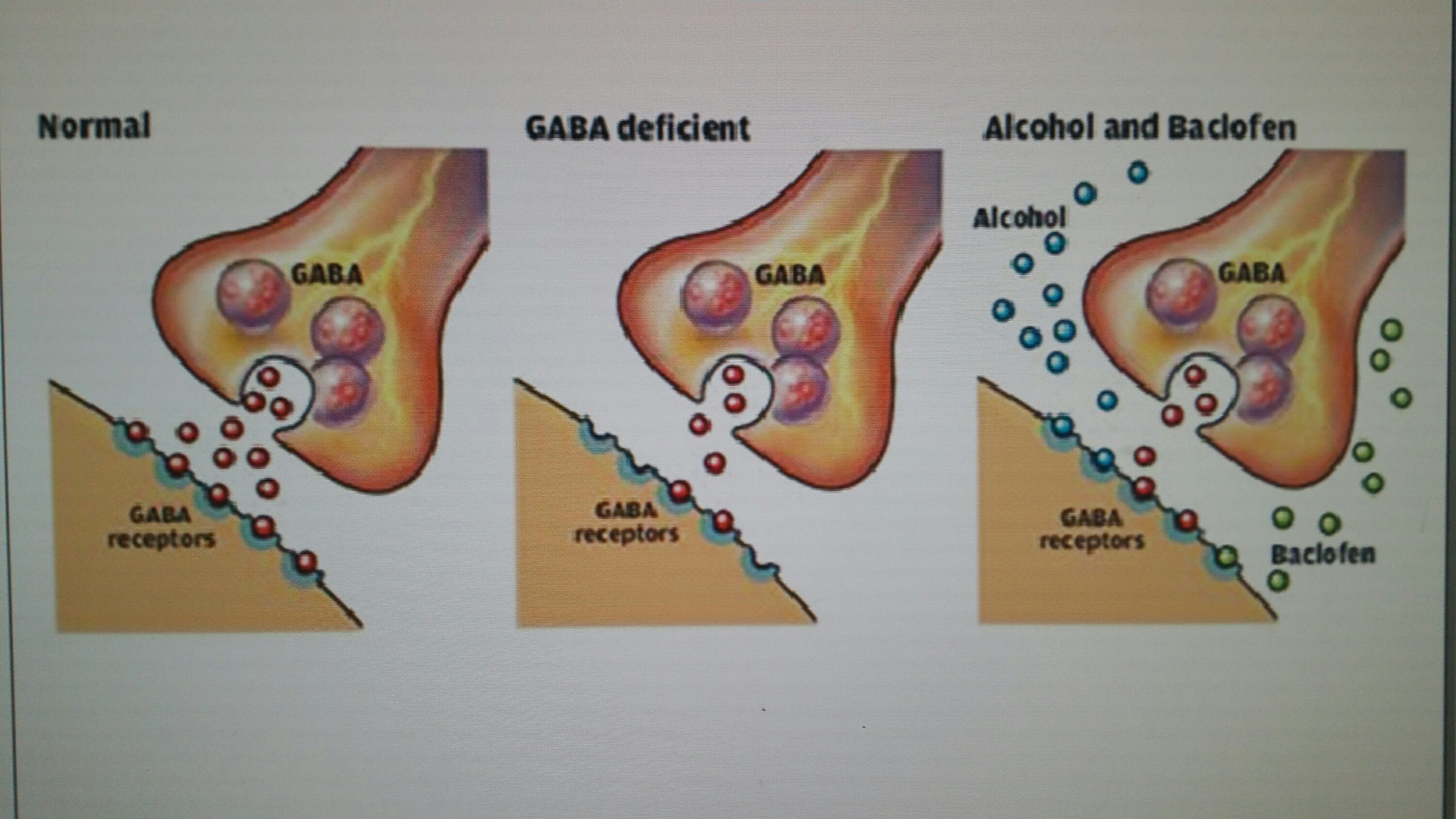 Le baclofene, quelques explications