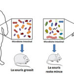 Obésité sévère, chirurgie bariatrique et dysbiose intestinale