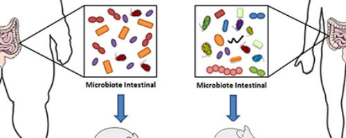 Obésité sévère, chirurgie bariatrique et dysbiose intestinale