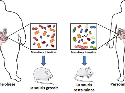 Obésité sévère, chirurgie bariatrique et dysbiose intestinale