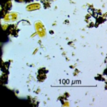 Microbiote et maladies auto-immunes : un lien qui se confirme