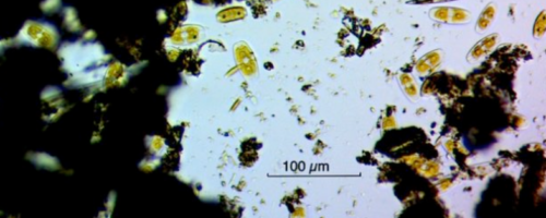 Microbiote et maladies auto-immunes : un lien qui se confirme