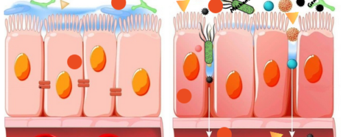 L’inflammation de la paroi intestinale pour les nuls