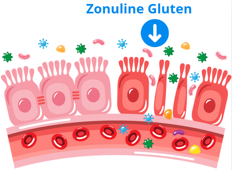 Gluten du blé moderne (le froment) et microbiote intestinal